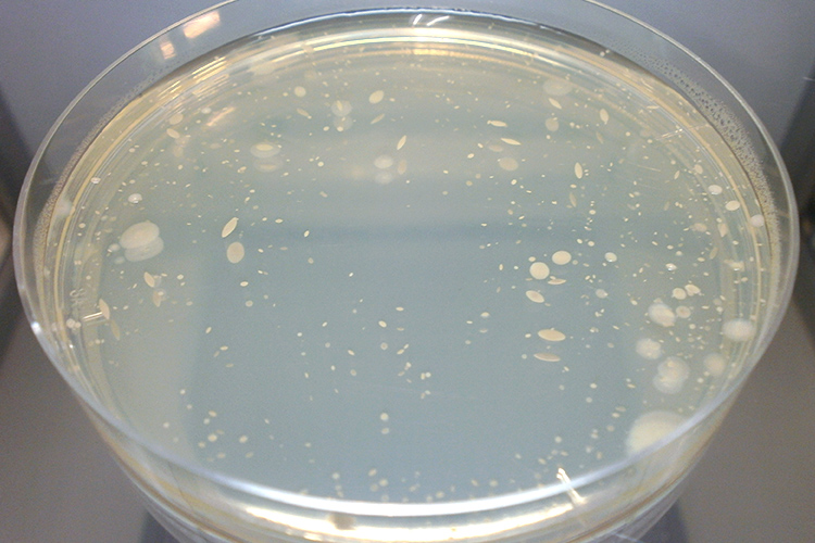 微生物検査